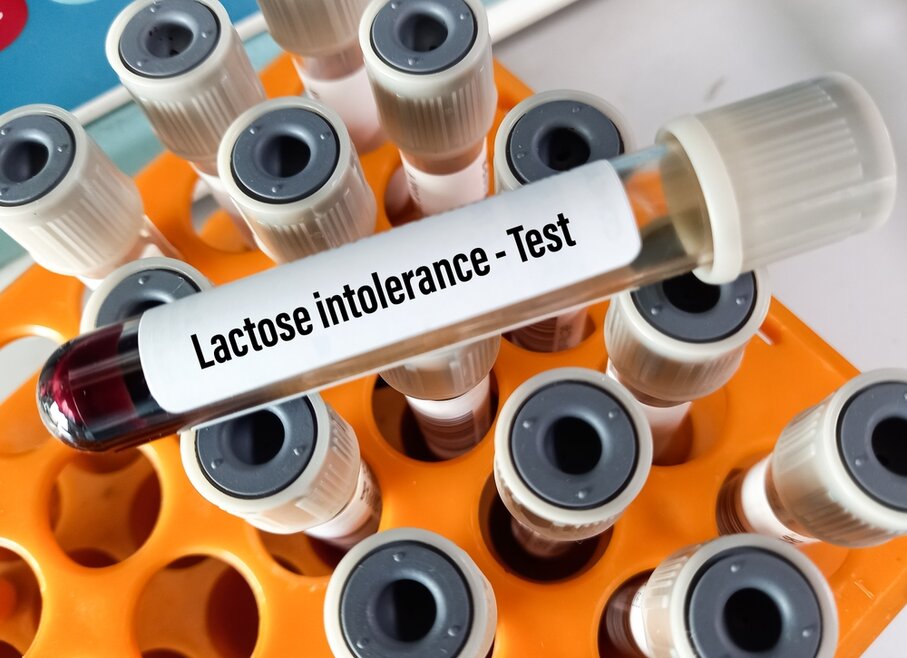 laktoz intoleransı testi