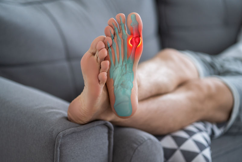 Gut Hastalığı Nedir?